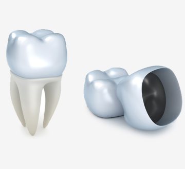 The-Importance-of-Getting-a-Dental-Crown-When-Needed